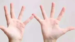 五指闭拢手上翘强大是什么性格，为什么有的人手指头挺直是弯的